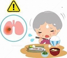イラスト：誤嚥に注意